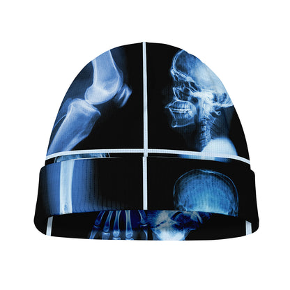 X-Ray Film Radiology Print Beanie
