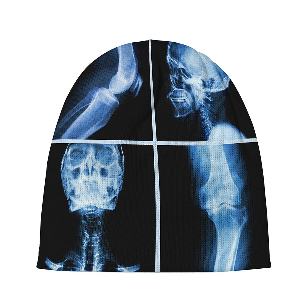 X-Ray Film Radiology Print Beanie