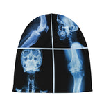 X-Ray Film Radiology Print Beanie