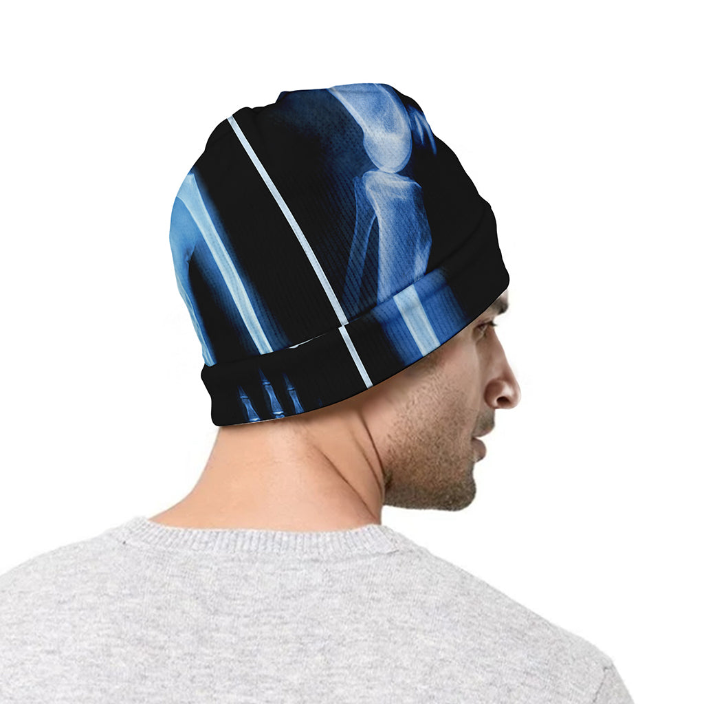 X-Ray Film Radiology Print Beanie