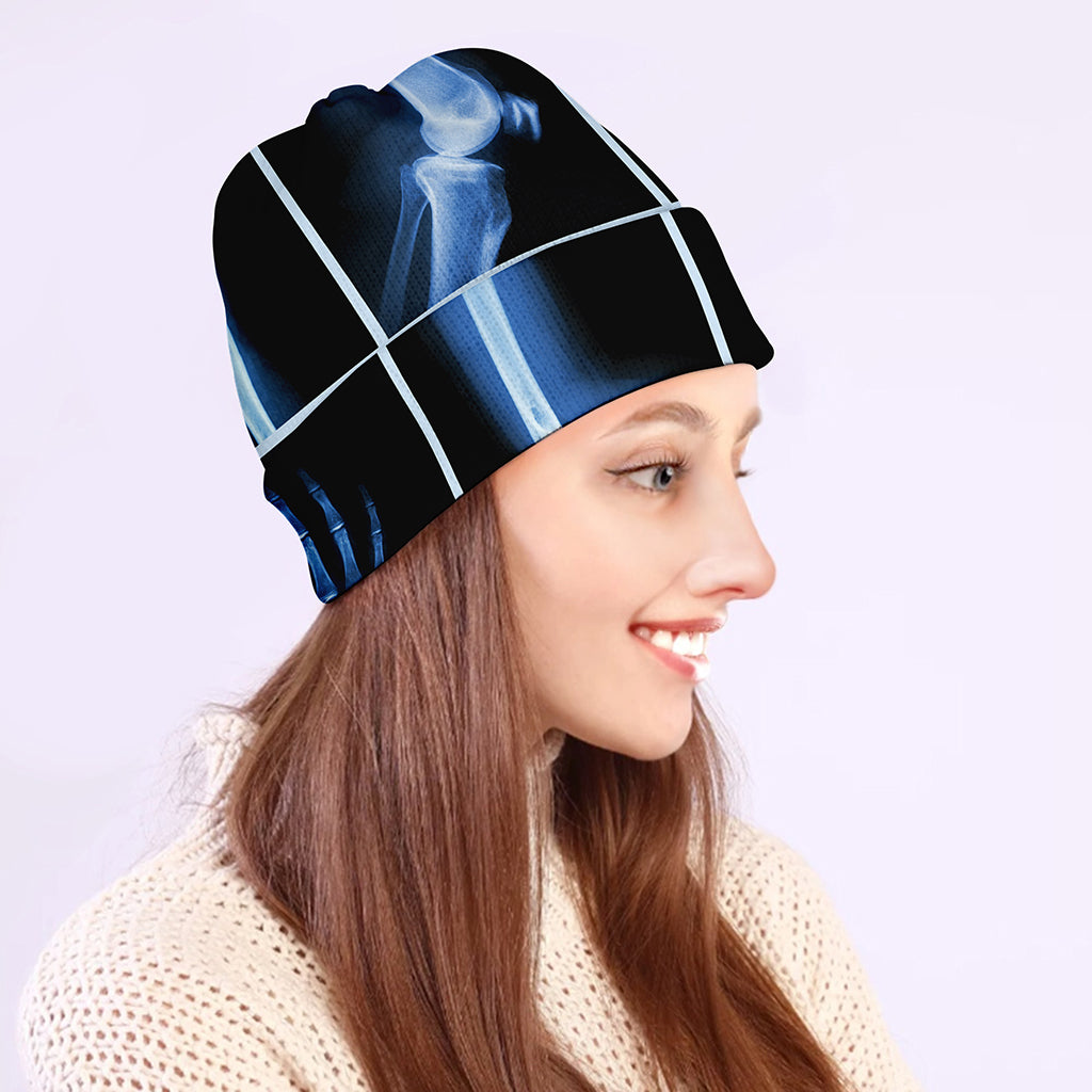 X-Ray Film Radiology Print Beanie