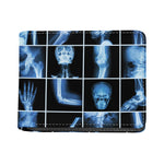 X-Ray Film Radiology Print Bifold Wallet