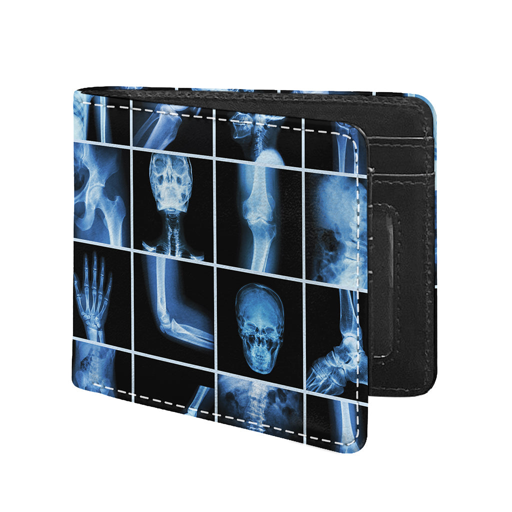 X-Ray Film Radiology Print Bifold Wallet