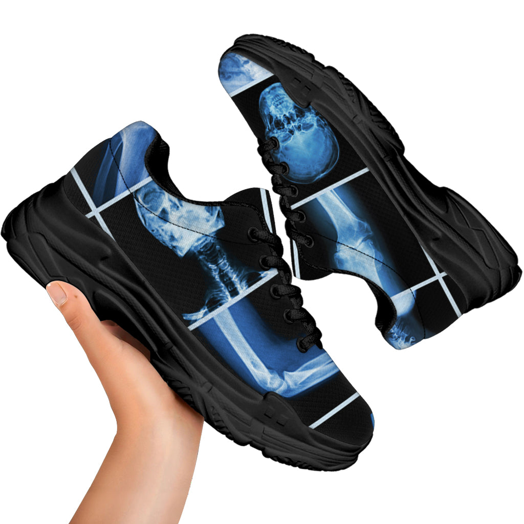 X-Ray Film Radiology Print Black Chunky Shoes
