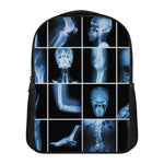 X-Ray Film Radiology Print Casual Backpack