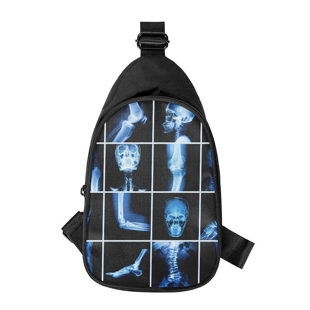 X-Ray Film Radiology Print Chest Bag