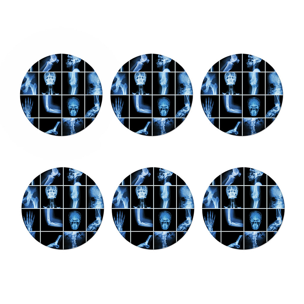 X-Ray Film Radiology Print Coaster Set