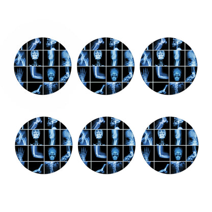 X-Ray Film Radiology Print Coaster Set