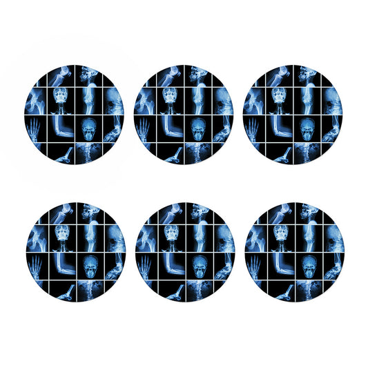 X-Ray Film Radiology Print Coaster Set