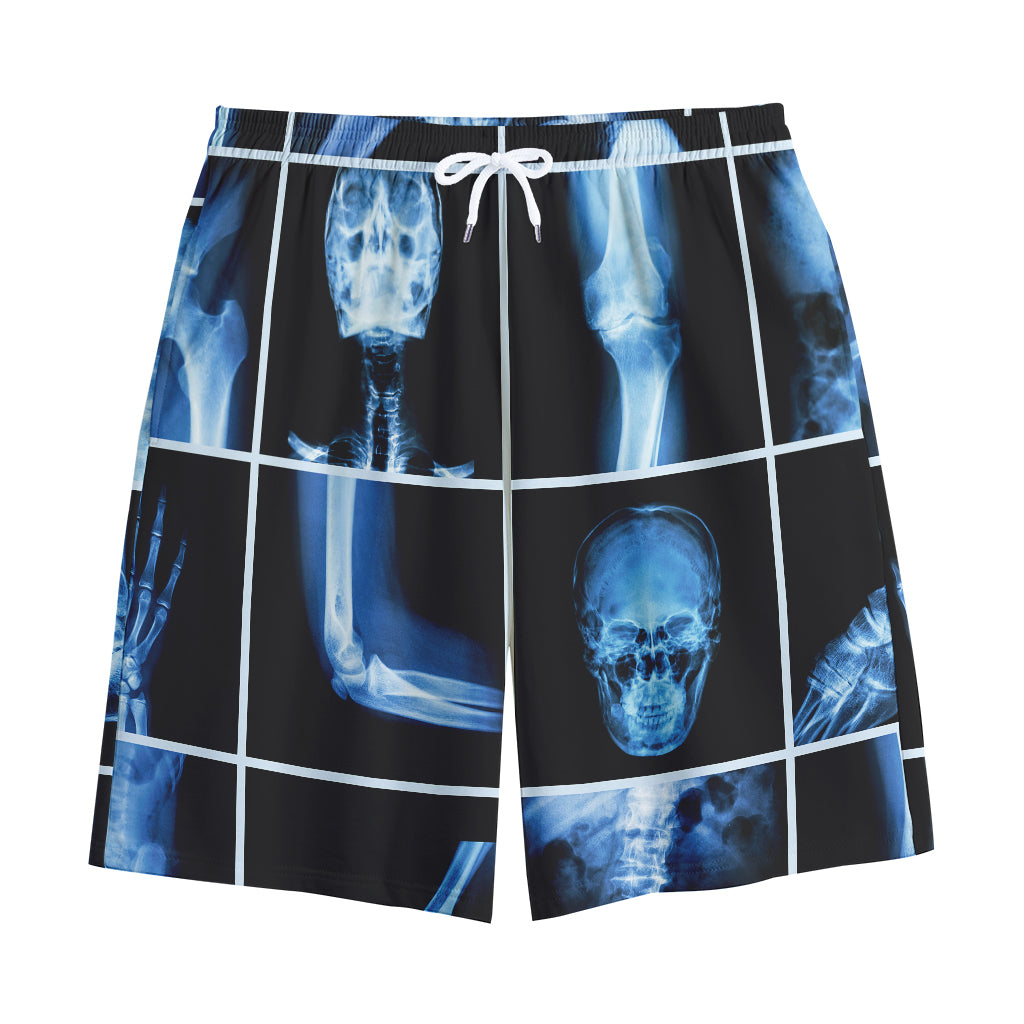 X-Ray Film Radiology Print Cotton Shorts
