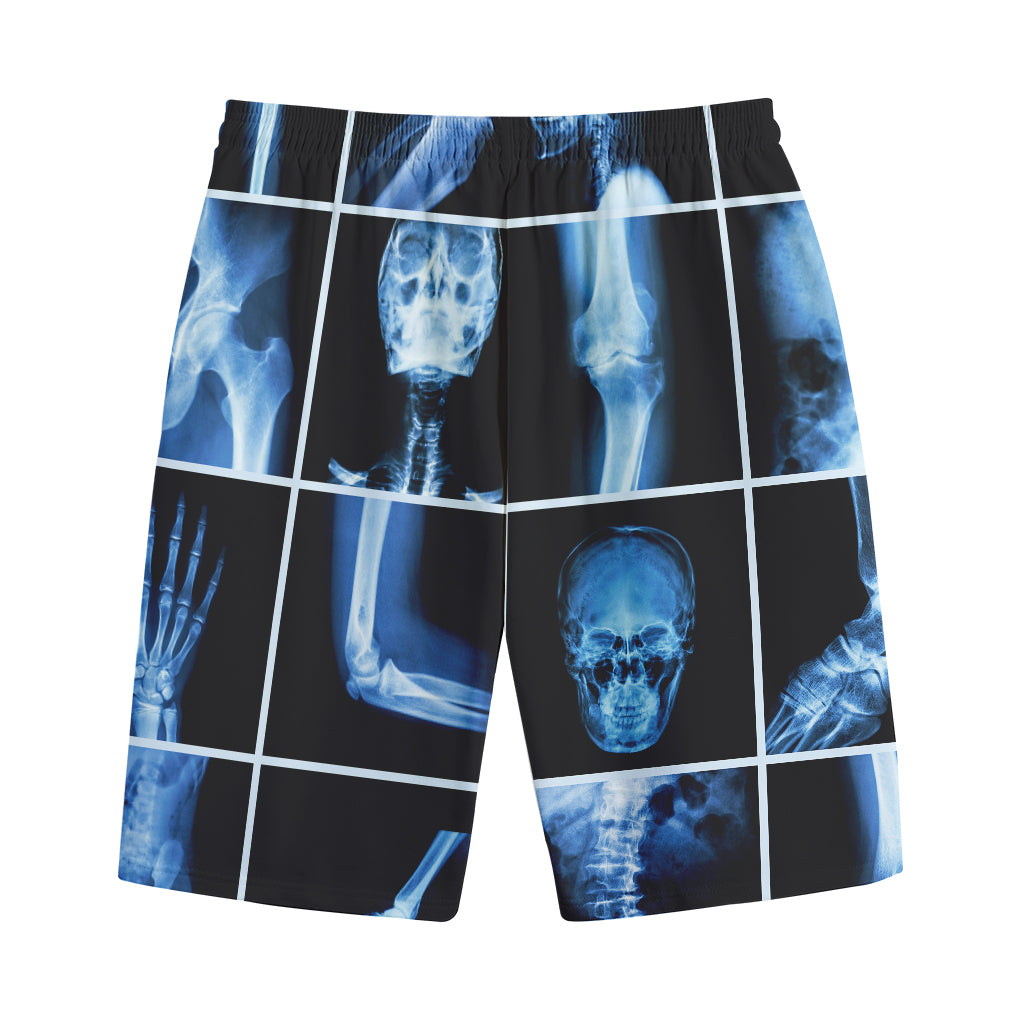 X-Ray Film Radiology Print Cotton Shorts
