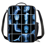 X-Ray Film Radiology Print Crossbody Lunch Bag