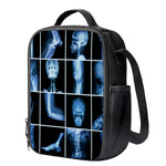 X-Ray Film Radiology Print Crossbody Lunch Bag