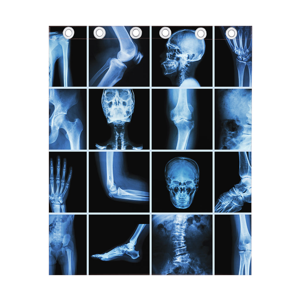 X-Ray Film Radiology Print Curtain