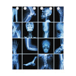 X-Ray Film Radiology Print Curtain