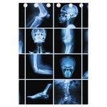 X-Ray Film Radiology Print Curtain