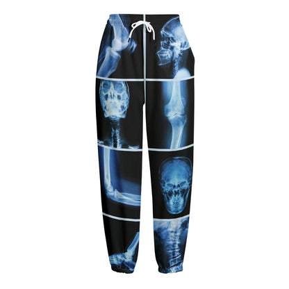 X-Ray Film Radiology Print Fleece Lined Knit Pants