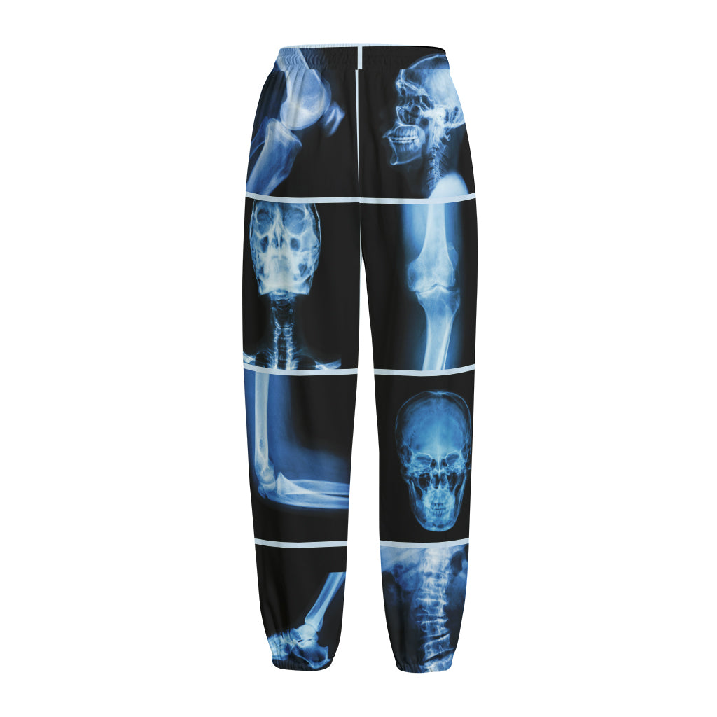 X-Ray Film Radiology Print Fleece Lined Knit Pants