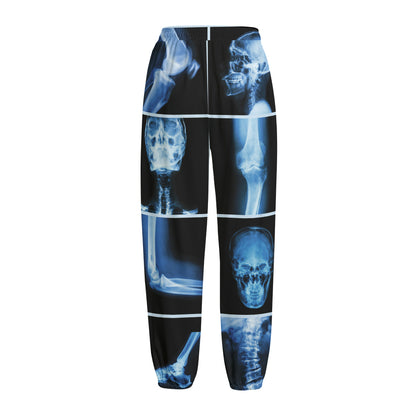 X-Ray Film Radiology Print Fleece Lined Knit Pants