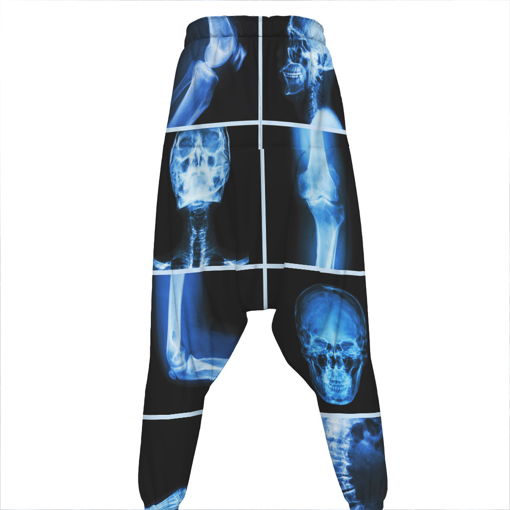 X-Ray Film Radiology Print Hammer Pants