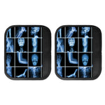 X-Ray Film Radiology Print Handle Covers