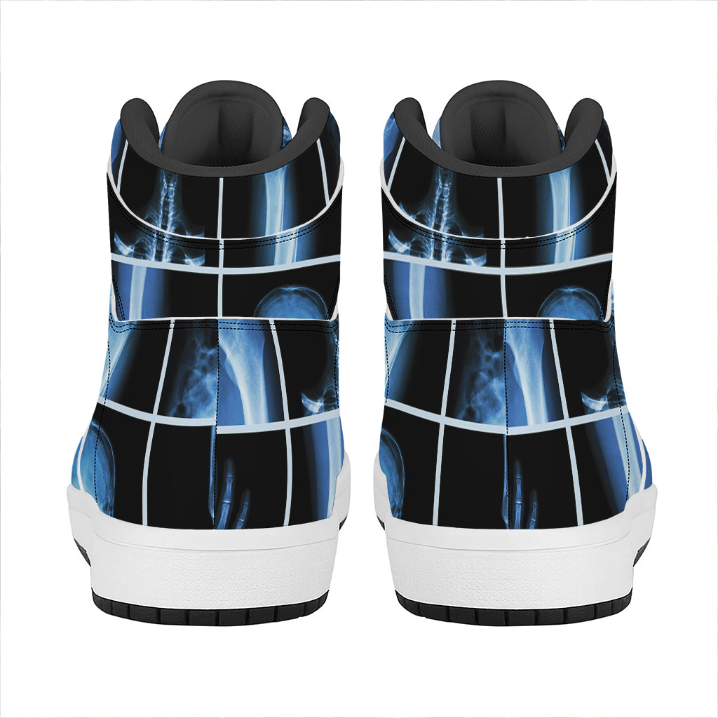 X-Ray Film Radiology Print High Top Leather Sneakers