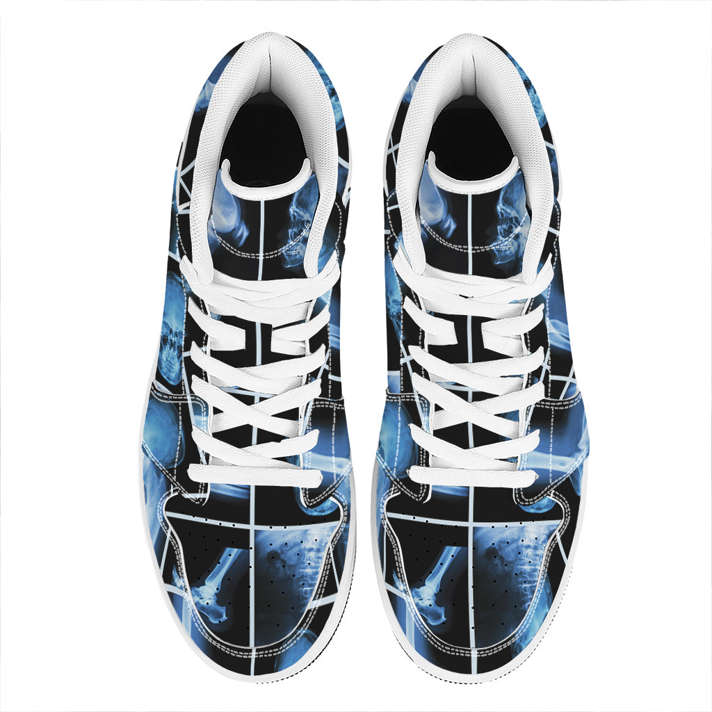 X-Ray Film Radiology Print High Top Leather Sneakers