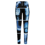 X-Ray Film Radiology Print High-Waisted Pocket Leggings