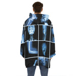 X-Ray Film Radiology Print Hoodie Blanket