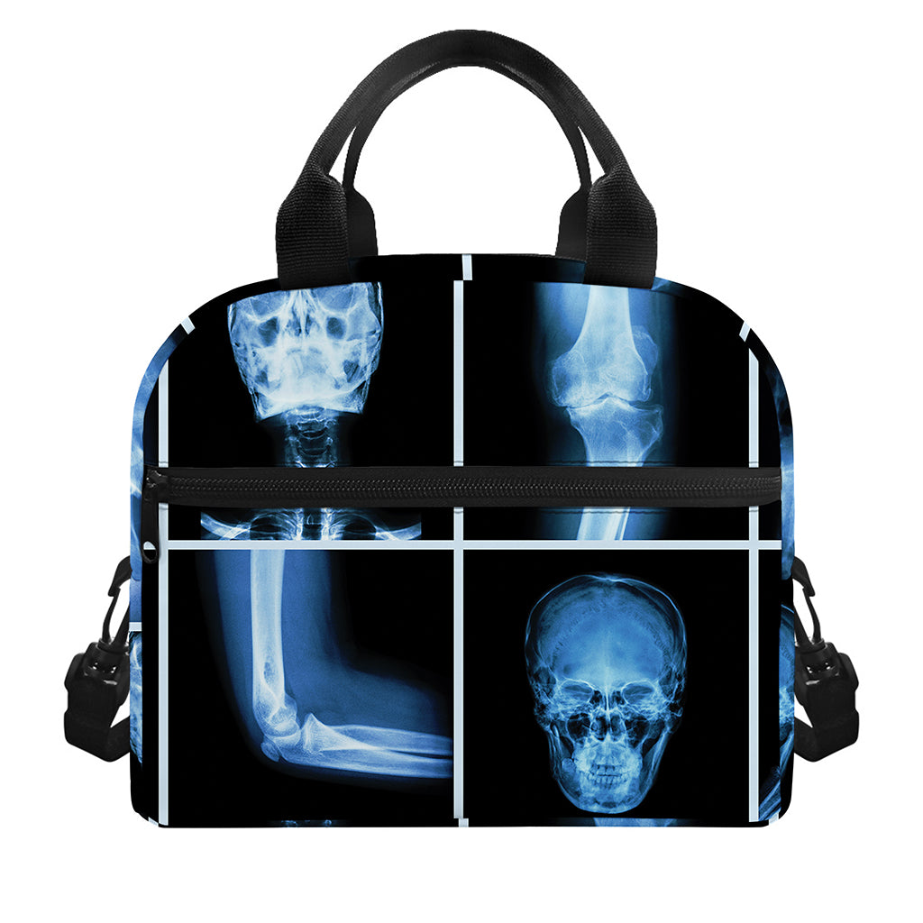 X-Ray Film Radiology Print Insulated Lunch Bag
