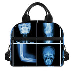 X-Ray Film Radiology Print Insulated Lunch Bag