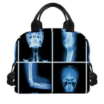 X-Ray Film Radiology Print Insulated Lunch Bag