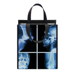X-Ray Film Radiology Print Insulated Lunch Tote