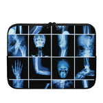 X-Ray Film Radiology Print Laptop Sleeve