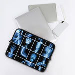 X-Ray Film Radiology Print Laptop Sleeve