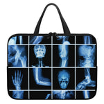 X-Ray Film Radiology Print Laptop Sleeve With Handle