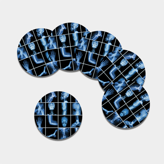 X-Ray Film Radiology Print Leather Coaster Set