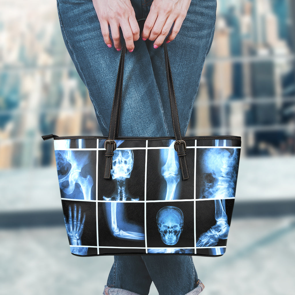 X-Ray Film Radiology Print Leather Tote Bag