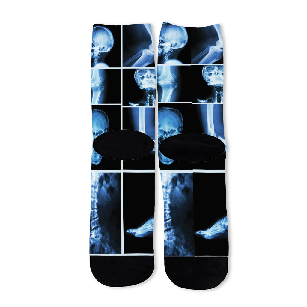 X-Ray Film Radiology Print Long Socks
