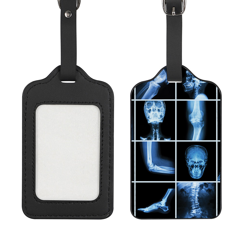 X-Ray Film Radiology Print Luggage Tag