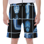 X-Ray Film Radiology Print Men's Beach Shorts