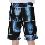 X-Ray Film Radiology Print Men's Beach Shorts