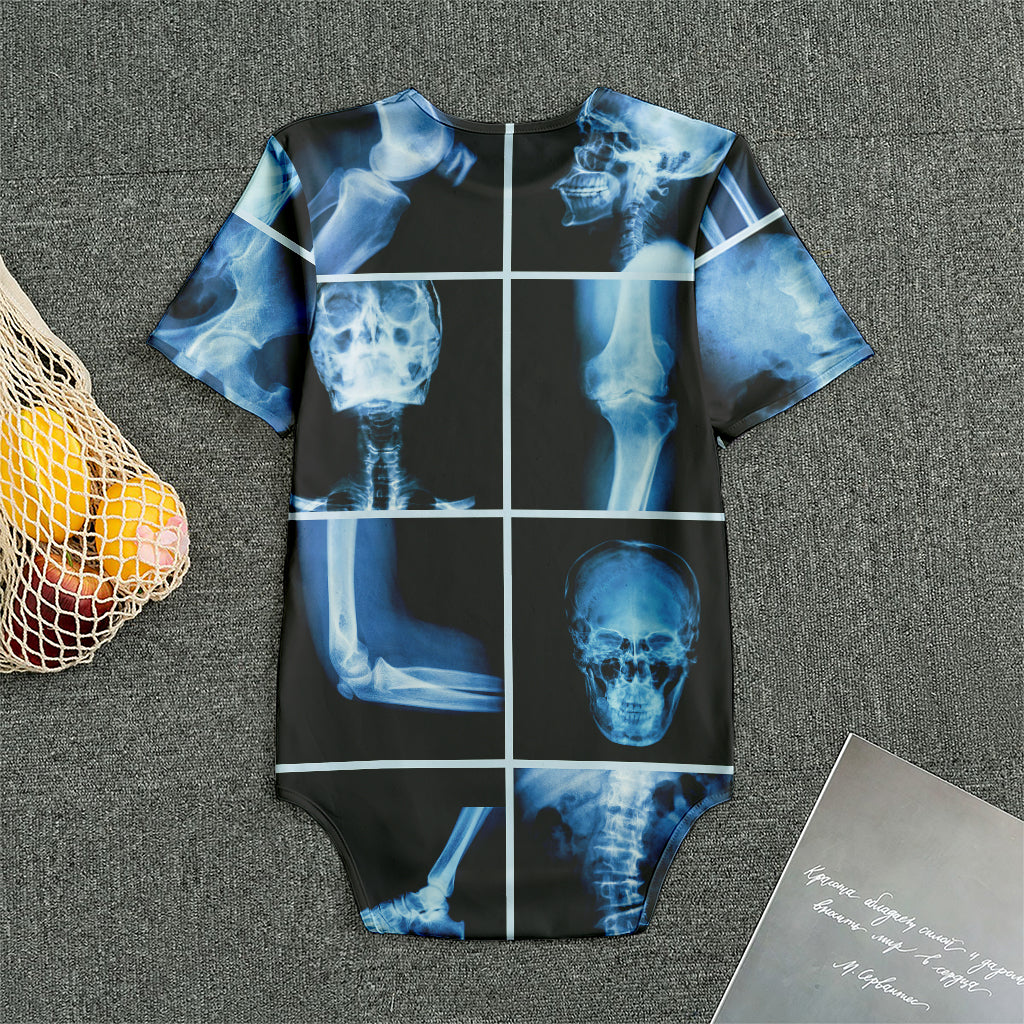 X-Ray Film Radiology Print Men's Bodysuit