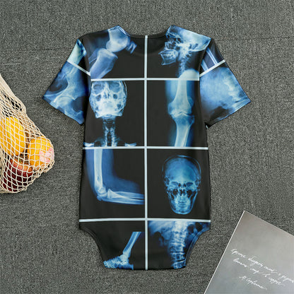 X-Ray Film Radiology Print Men's Bodysuit
