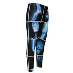X-Ray Film Radiology Print Men's Compression Pants