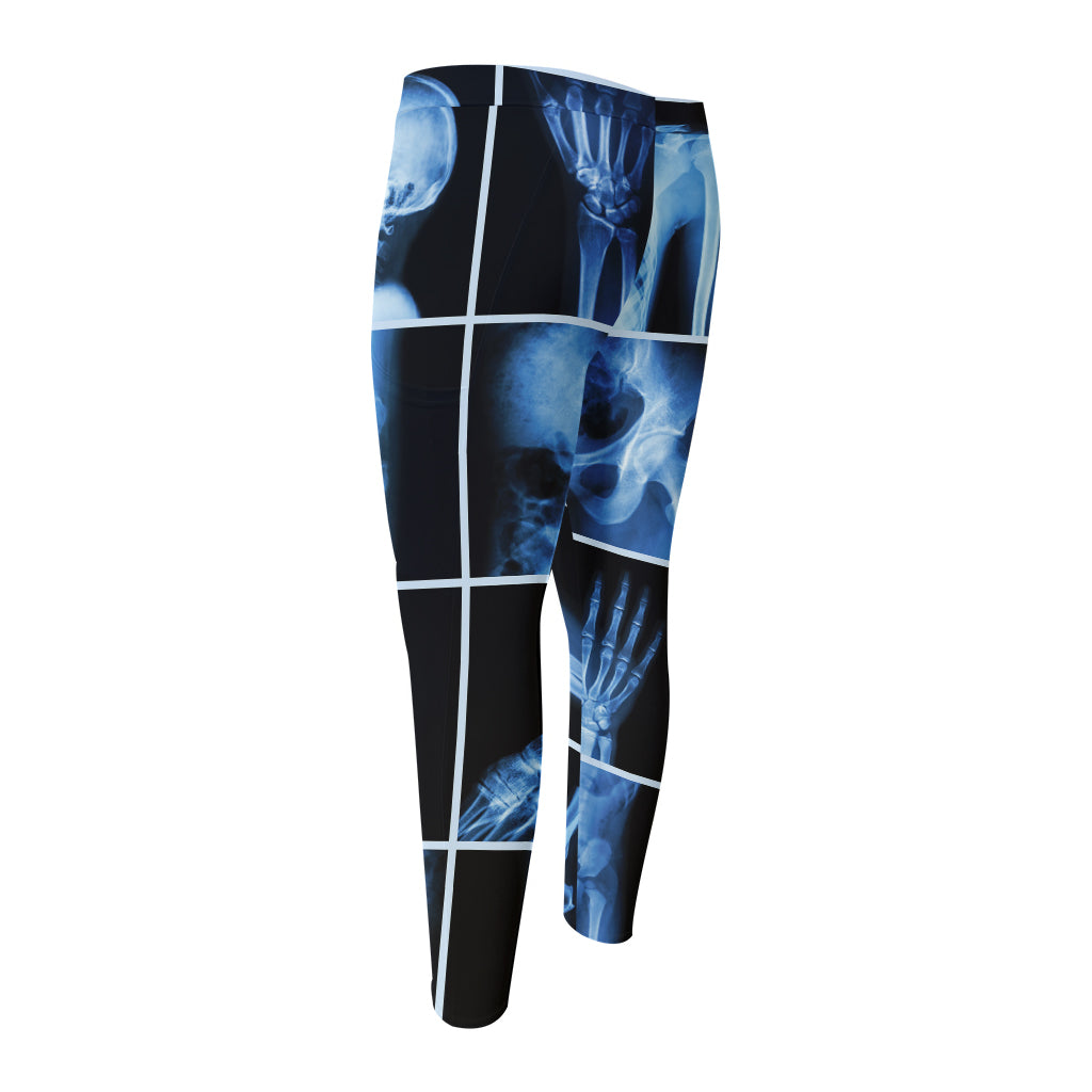 X-Ray Film Radiology Print Men's Compression Pants