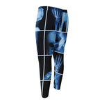 X-Ray Film Radiology Print Men's Compression Pants