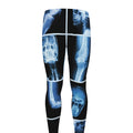 X-Ray Film Radiology Print Men's Leggings