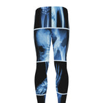 X-Ray Film Radiology Print Men's leggings