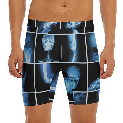 X-Ray Film Radiology Print Men's Long Boxer Briefs